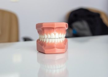 Damaged Teeth