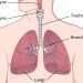 Knowledge of Squamous Lung Cancer