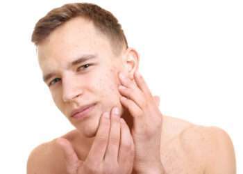 Male Skin Problems: 7 Things You Should Know