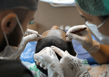 Common Hair Transplant Issues (And How to Fix Them)