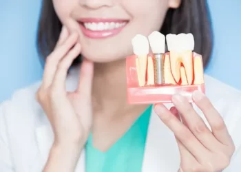 When Is the Best Time to Get Dental Implants?
